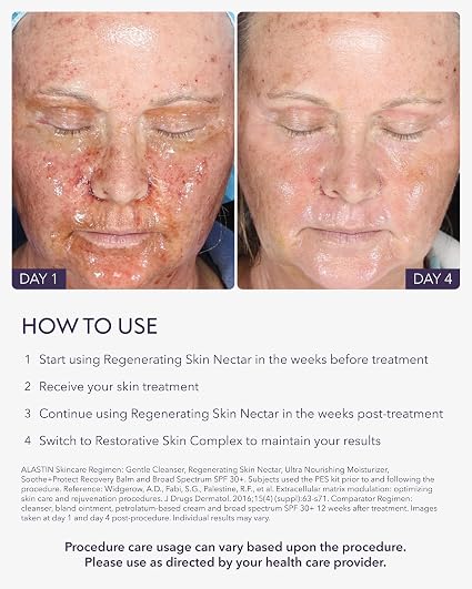 ALASTIN Skincare Regenerating Skin Nectar Face Moisturizer (1 oz) | Hydrating Serum Designed to Maximize Procedure Results, Soothe Skin and Reduce Recovery Time, Suitable for Sensitive Skin